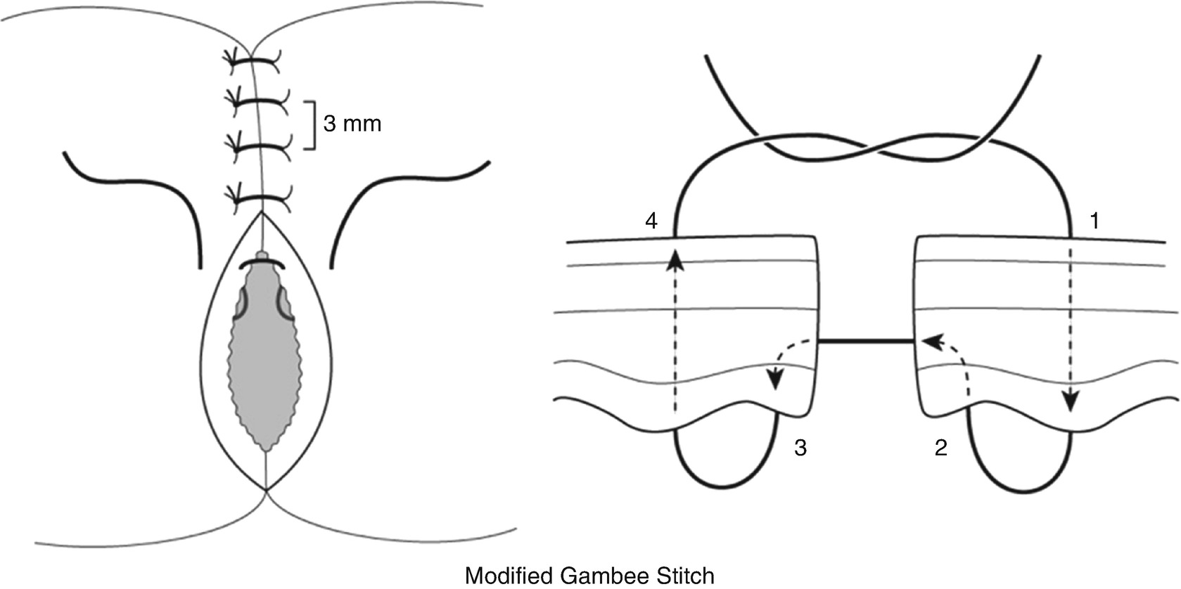 Mammary and Intestinal Surgery